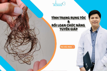 Rụng tóc do rối loạn tuyến giáp