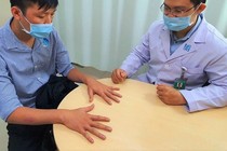 Tăng cân, viêm da hậu Covid-19