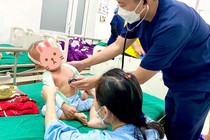 Phẫu thuật “tối khẩn” cứu trẻ 16 tháng nguy kịch vì bị khối bê tông đè lên người