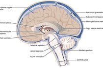 Người già lú lẫn, rối loạn dáng đi do giãn não thất