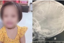 Bé gái 3 tuổi bị đóng đinh vào đầu tử vong: Gã cha dượng sẽ bị chuyển sang mức án tù chung thân hoặc tử hình