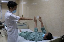 Điều trị viêm tủy thị thần kinh thoát liệt