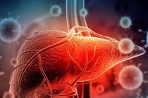 Báo cáo ngay các trường hợp viêm gan cấp tính không rõ nguyên nhân