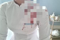 Vụ nữ sinh dùng guốc đánh vào đầu bạn: Cha nạn nhân nói gì?
