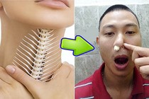 Video: Mẹo chữa hóc xương cá chỉ... 1 phút 30 giây 