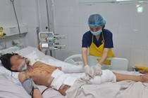 Chơi pháo nổ, bé trai 12 tuổi ở Đà Nẵng đa chấn thương nặng
