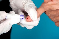 AI giúp nhận diện dấu hiệu ung thư chỉ với 1 giọt máu khô