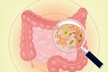Dấu hiệu cảnh báo đường ruột cực "bẩn", cần cải thiện ngay