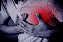 Thói quen xấu khiến người trẻ dễ bị nhồi máu cơ tim