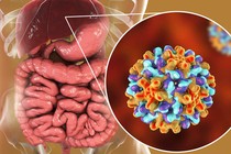 Ai cũng có thể mắc viêm gan B, không nên chủ quan