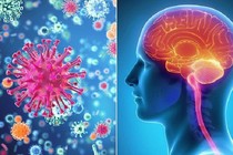 Bệnh viêm màng não mô cầu có lây không?