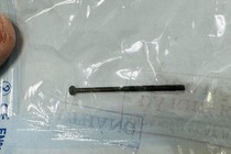 Gắp dị vật đinh vít dài 4cm trong dạ dày bé trai 3 tuổi