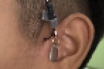 Đứng xem câu cá, bé trai 11 tuổi bị móc câu đâm sâu vào vùng tai