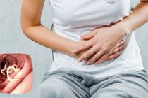 Dấu hiệu "âm thầm" cảnh báo cơ thể đang chứa đầy giun, cần tẩy gấp