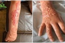 Mê mẩn trào lưu xăm henna, giới trẻ phải chịu hệ lụy