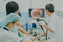 Cháu bé 29 tháng tuổi hoại tử thực quản vì nuốt pin cúc