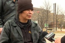 Canada: Đến bệnh viện phẫu thuật cắt chân phải, tỉnh dậy hoảng hồn vì...