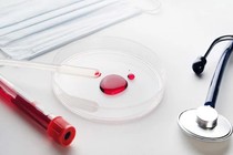 Kinh ngạc quá trình vi nhựa tàn phá cơ thể con người 