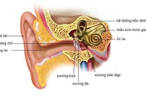 Rối loạn tiền đình