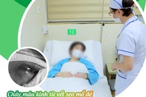 3 năm chảy máu kinh từ vết sẹo mổ đẻ