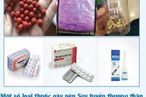 Tự dùng thuốc trị đau khớp bị biến chứng suy tuyến thượng thận nguy kịch