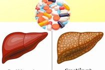 Địa chỉ vàng: Một số loại thực phẩm chức năng hỗ trợ gan nhiễm mỡ