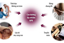 Bác sĩ chỉ rõ đường lây truyền của Virus HPV gây ung thư cổ tử cung