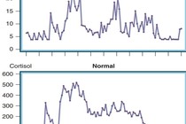 Ảnh: Dao động nồng độ Cortisol và ACTH trong ngày