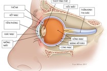 Cách điều trị ung thư mắt