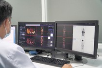 Bác sĩ đang theo dõi kết quả chụp PET/CT trên màn hình.