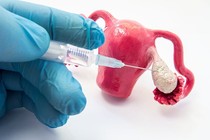 Bác sĩ chỉ rõ cách ăn uống, sinh hoạt sau khi tiêm kích trứng