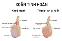 Đang ngủ tỉnh giấc vì đau, thanh niên 16 tuổi bị xoắn tinh hoàn hoại tử