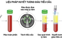 Huyết tương giàu tiểu cầu trị viêm khớp, viêm gân