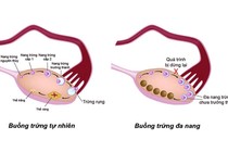 Loại xét nghiệm giúp ước đoán khả năng sinh sản của chị em phụ nữ 