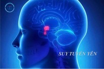 Sau sinh cẩn thận mắc bệnh suy tuyến yên nguy hiểm: cần nhận biết sớm