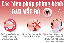 Bệnh đau mắt đỏ gia tăng: Những biện pháp phòng tránh bệnh đau mắt đỏ 