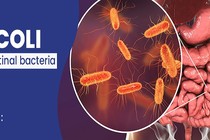 Nhiễm vi khuẩn E.coli gây biến chứng như thế nào?