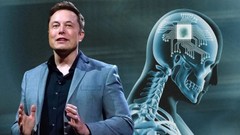 Chip não Neuralink của Elon Musk gặp sự cố