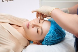 Căng da mặt bằng chỉ Collagen - Giải pháp trẻ hóa da an toàn, hiệu quả