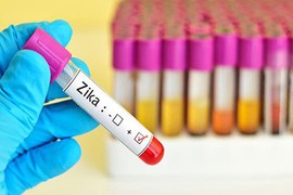 TP.HCM: Đã có 29 ca nhiễm Zika