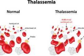 Bệnh tan máu bẩm sinh là gì và nguy hiểm như thế nào?