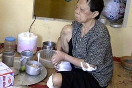 TT Da liễu Hà Đông ăn bớt thuốc của bệnh nhân phong 