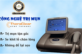 Trị mụn công nghệ cao không để lại sẹo