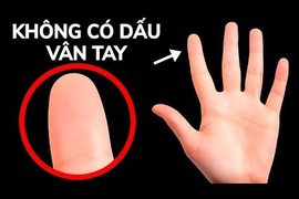 Video: Chuyện gì sẽ xảy ra nếu bạn mất dấu vân tay?