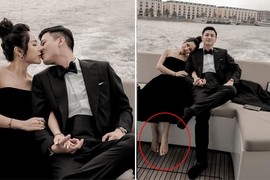 Bạn gái mới của Huỳnh Anh bị soi chỉnh ảnh photoshop