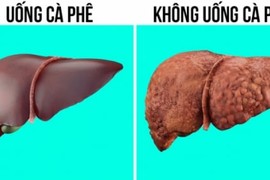 Phụ nữ uống cà phê sẽ có ít mỡ thừa, gan khỏe và sống thọ hơn