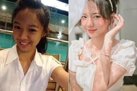 Bị bạn bè tẩy chay vì xấu, cô gái lột xác thành hot girl xinh đẹp