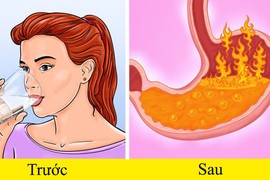 Duy trì 6 thói quen tai hại này sẽ khiến trào ngược dạ dày nghiêm trọng hơn