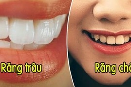 Nhìn tướng răng biết tương lai bạn thành tỷ phú hay nghèo nàn 