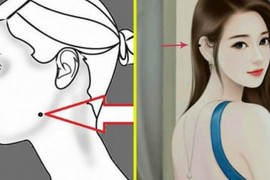 3 nốt ruồi tụ lộc giúp chủ nhân giàu có sung túc